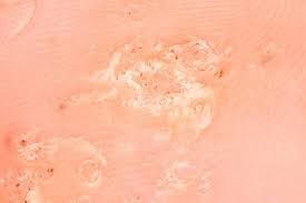 Warts and Verrucas information sheet